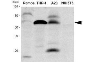 Image no. 2 for anti-Interferon Regulatory Factor 5 (IRF5) (AA 176-240) antibody (ABIN933028)