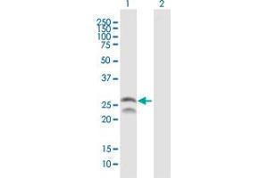 Image no. 1 for anti-FEV (ETS Oncogene Family) (FEV) (AA 1-238) antibody (ABIN527173)