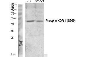 Western Blot (WB) analysis of specific cells using Phospho-KOR-1 (S369) Polyclonal Antibody.