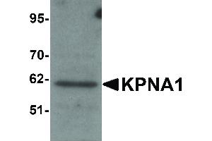 Image no. 1 for anti-Karyopherin alpha 1 (Importin alpha 5) (KPNA1) (N-Term) antibody (ABIN6657021)
