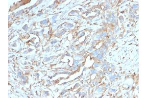 Image no. 5 for anti-CD274 (PD-L1) (AA 39-191) antibody (ABIN6939571)