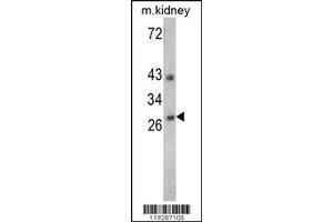 Western Blotting (WB) image for anti-Endonuclease G (ENDOG) antibody (ABIN2158695)