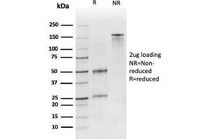 Image no. 1 for anti-CD19 Molecule (CD19) (AA 96-281) antibody (ABIN6941101)