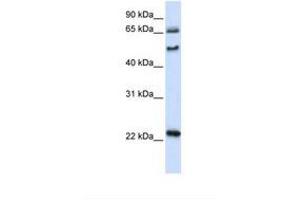 Image no. 1 for anti-UNC Homeobox (UNCX) (AA 74-123) antibody (ABIN6739205)