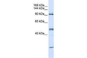 Image no. 1 for anti-Alanyl tRNA Synthetase (AARS) (N-Term) antibody (ABIN2778779)