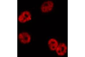 Image no. 5 for anti-NF-kappa-B inhibitor beta (NFKBIB) (pSer23) antibody (ABIN6256201)