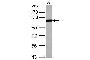 Image no. 3 for anti-Adducin 1 (Alpha) (ADD1) (Center) antibody (ABIN2855099)