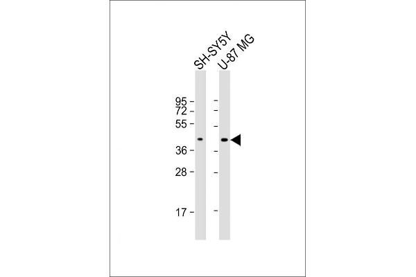 GPR45 Antikörper  (AA 121-149)