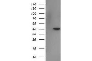 Image no. 2 for anti-N-terminal EF-Hand Calcium Binding Protein 1 (NECAB1) antibody (ABIN2727049)