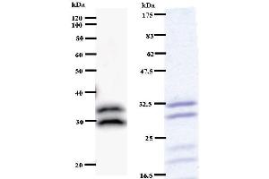 Image no. 1 for anti-tRNA Methyltransferase 61 Homolog A (TRMT61A) antibody (ABIN930921)
