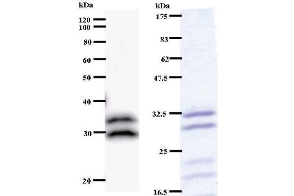 anti-tRNA Methyltransferase 61 Homolog A (TRMT61A) antibody