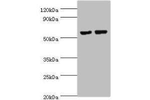 Matrilin 3 antibody  (AA 277-486)