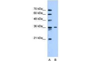 Image no. 1 for anti-Solute Carrier Family 35 (UDP-N-Acetylglucosamine (UDP-GlcNAc) Transporter), Member A3 (SLC35A3) antibody (ABIN2462748)