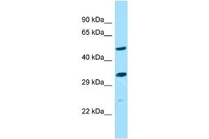 Image no. 1 for anti-Asparagine-Linked Glycosylation 10, alpha-1,2-Glucosyltransferase Homolog B (ALG10B) (Middle Region) antibody (ABIN2790719)