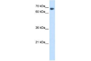 Image no. 2 for anti-TAF6 RNA Polymerase II, TATA Box Binding Protein (TBP)-Associated Factor, 80kDa (TAF6) (N-Term) antibody (ABIN2775955)