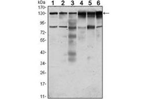 Image no. 1 for anti-PTK7 Protein tyrosine Kinase 7 (PTK7) antibody (ABIN1108789)
