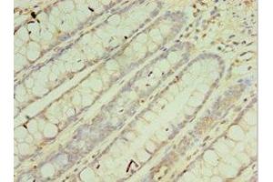 Immunohistochemistry of paraffin-embedded human colon tissue using ABIN7149543 at dilution of 1:100