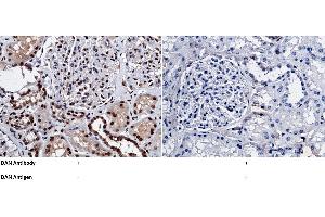 Image no. 1 for anti-Neuroblastoma 1, DAN Family BMP Antagonist (NBL1) (AA 1-180) antibody (ABIN1995901)