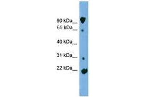 Image no. 1 for anti-Kelch-Like 2, Mayven (KLHL2) (AA 179-228) antibody (ABIN6744966)