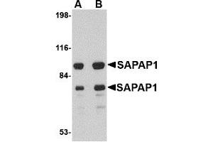 Western Blotting (WB) image for anti-Discs, Large (Drosophila) Homolog-Associated Protein 1 (DLGAP1) (Middle Region) antibody (ABIN1031076)