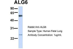 Image no. 1 for anti-Asparagine-Linked Glycosylation 6, alpha-1,3-Glucosyltransferase Homolog (ALG6) (N-Term) antibody (ABIN2782789)