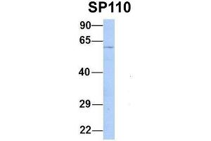 Image no. 2 for anti-SP110 Nuclear Body Protein (SP110) (Middle Region) antibody (ABIN2775055)