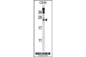 Image no. 1 for anti-RAB6B, Member RAS Oncogene Family (RAB6B) (AA 167-195), (C-Term) antibody (ABIN657771)