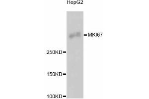 Image no. 6 for anti-Antigen Identified By Monoclonal Antibody Ki-67 (MKI67) antibody (ABIN4904148)