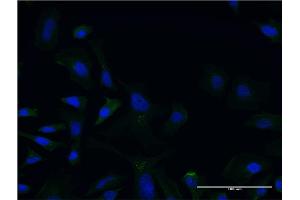 Image no. 3 for anti-Lecithin-Cholesterol Acyltransferase (LCAT) (AA 98-197) antibody (ABIN948078)