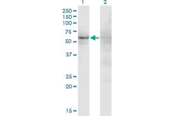 anti-Zinc Finger Protein 180 (ZNF180) (AA 176-285) antibody