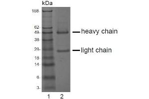 Image no. 3 for anti-Acid Phosphatase, Prostate (ACPP) antibody (ABIN238332)