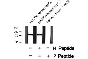 Image no. 2 for anti-Protein Kinase C, gamma (PRKCG) (pThr655) antibody (ABIN6271960)