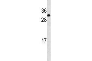 Image no. 1 for anti-Insulin-Like Growth Factor 2 (IGF2) (AA 39-68) antibody (ABIN3031347)