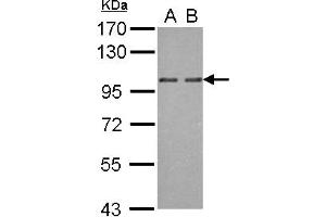 Image no. 2 for anti-Oxysterol Binding Protein 2 (OSBP2) (AA 596-835) antibody (ABIN1499917)