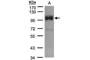 Image no. 1 for anti-Transient Receptor Potential Cation Channel, Subfamily C, Member 6 (TRPC6) (C-Term) antibody (ABIN2855924)