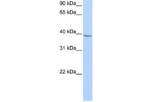 Image no. 1 for anti-Nudix (Nucleoside Diphosphate Linked Moiety X)-Type Motif 17 (NUDT17) antibody (ABIN630706)