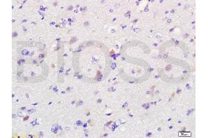 Image no. 4 for anti-Macrophage Migration Inhibitory Factor (Glycosylation-Inhibiting Factor) (MIF) (AA 51-115) antibody (ABIN736836)