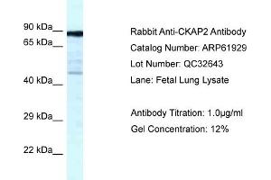 Image no. 1 for anti-Cytoskeleton Associated Protein 2 (CKAP2) (C-Term) antibody (ABIN2788952)
