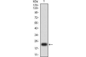 BRIP1 Antikörper  (AA 904-986)