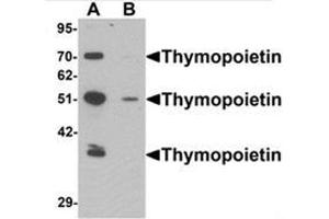 Image no. 2 for anti-Thymopoietin (TMPO) (N-Term) antibody (ABIN1450080)