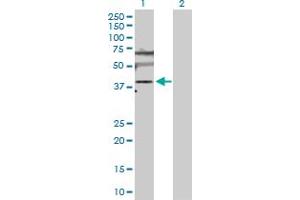 Image no. 1 for anti-Solute Carrier Family 25 (Mitochondrial Carrier, Adenine Nucleotide Translocator), Member 6 (SLC25A6) (AA 1-298) antibody (ABIN513348)