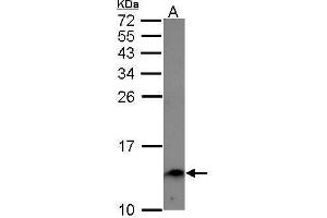 WB Image Sample (30 ug of whole cell lysate) A: A549 15% SDS PAGE antibody diluted at 1:1000