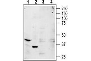 ADORA1 Antikörper  (3rd Intracellular Loop)