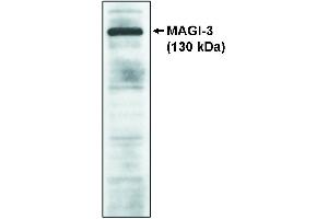 Image no. 1 for anti-SH3-Domain Binding Protein 4 (SH3BP4) antibody (ABIN306590)