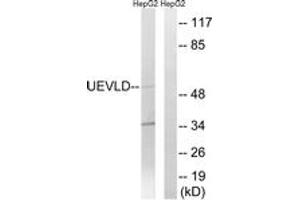 anti-UEV and Lactate/malate Dehyrogenase Domains (UEVLD) (AA 141-190) antibody