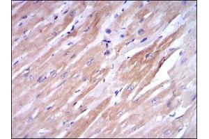 Image no. 4 for anti-Fast Skeletal Troponin I (TNNI2) antibody (ABIN969441)