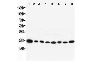 Image no. 2 for anti-RAB8A, Member RAS Oncogene Family (RAB8A) (AA 170-183), (C-Term) antibody (ABIN3042554)