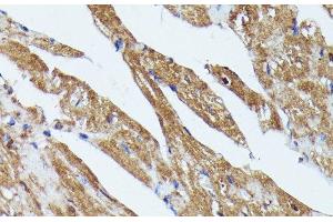Immunohistochemistry of paraffin-embedded Mouse heart using TBCB Polyclonal Antibody at dilution of 1:100 (40x lens).