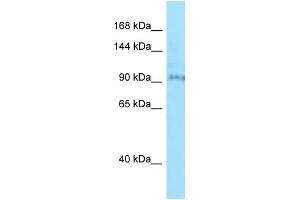 Image no. 1 for anti-Bardet-Biedl Syndrome 9 (BBS9) (N-Term) antibody (ABIN2774438)