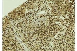 Image no. 1 for anti-Squamous Cell Carcinoma Antigen Recognized By T Cells 3 (SART3) (C-Term) antibody (ABIN6264927)